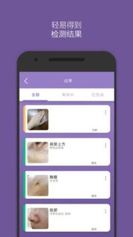 扫一扫识别皮肤病-图3