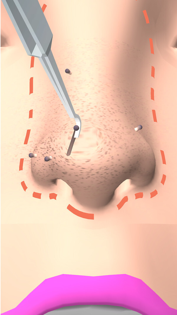 干净的鼻子 干净的鼻子