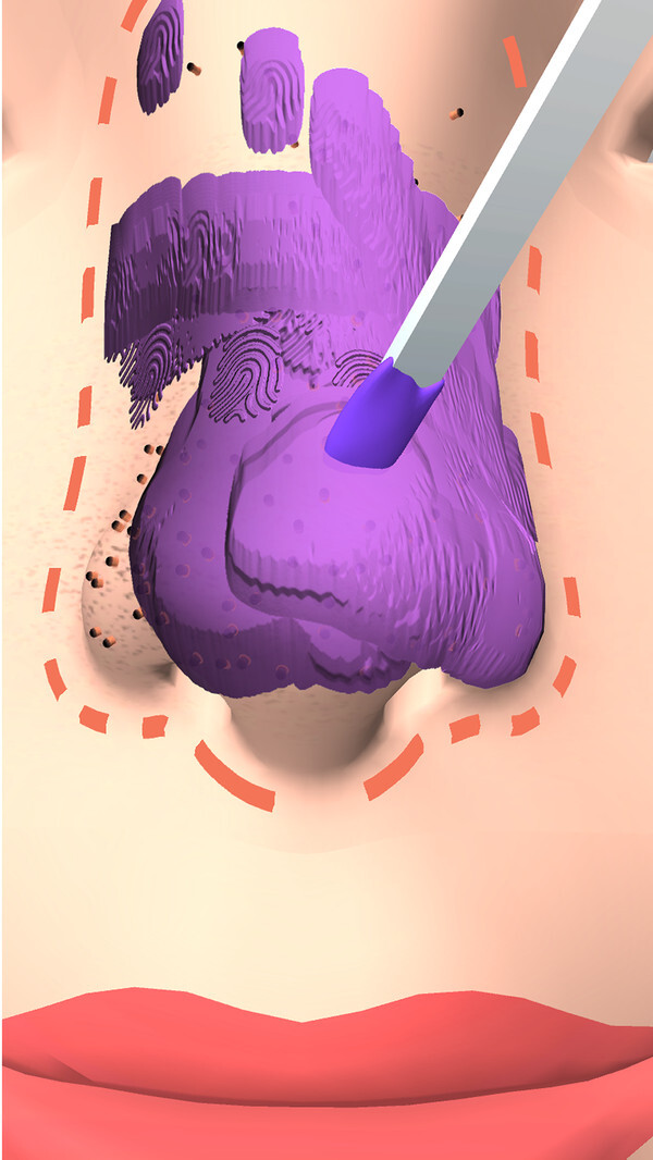 干净的鼻子 干净的鼻子