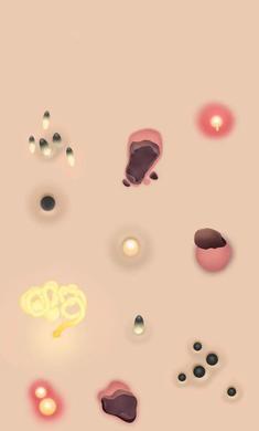 挤痘痘达人 挤痘痘达人