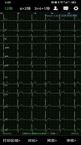 心电一张网-图2