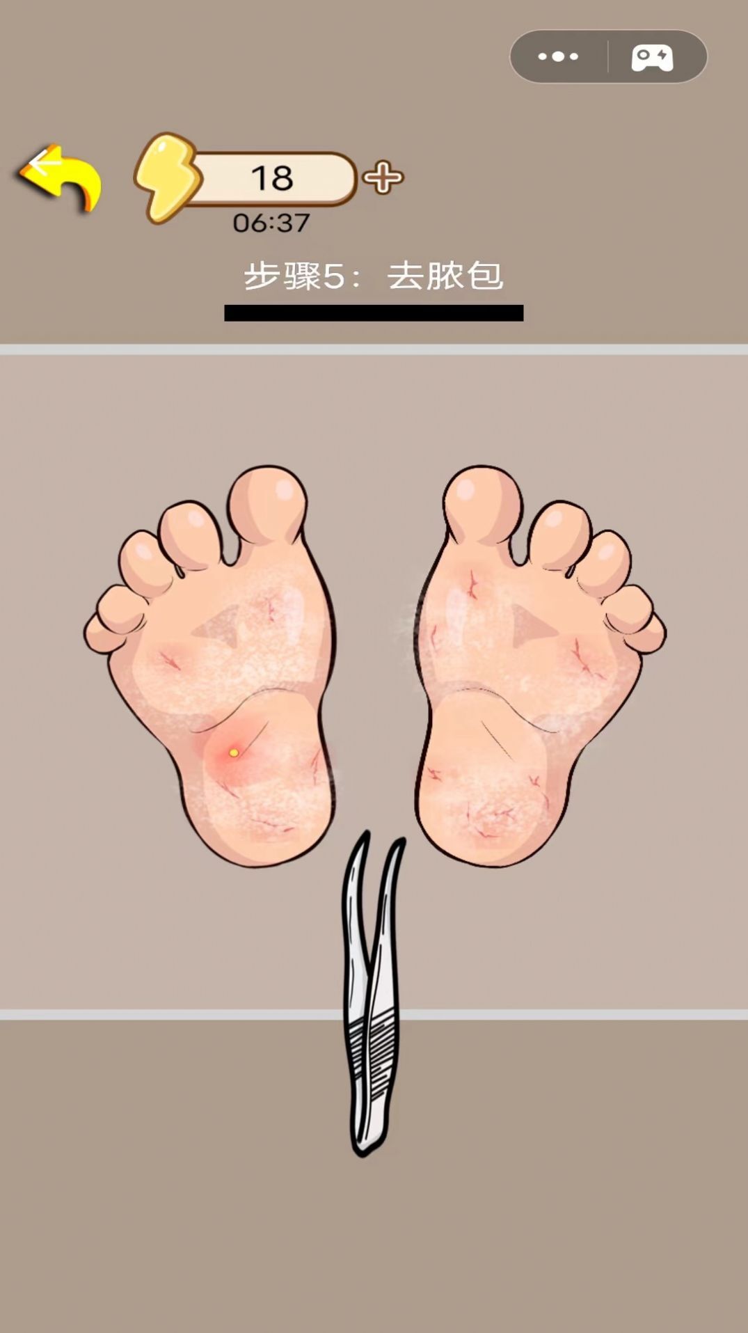 解压日志 解压日志