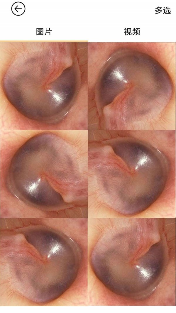 蜂鸟采耳 蜂鸟采耳